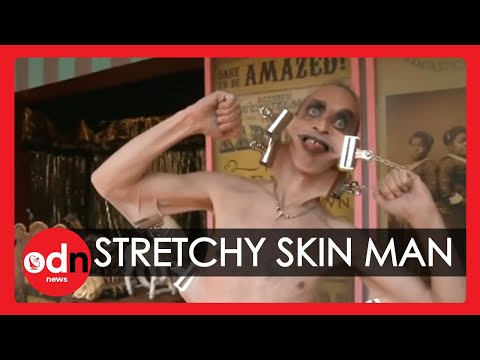 Meet the man with the world&#039;s stretchiest skin ... WEIRD!